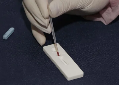 Teste coronavírus